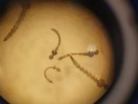 NOTIFICAÇÕES DE DENGUE TÊM REDUÇÃO ACUMULADA DE MAIS DE 200% NO ÚLTIMO QUADRIMESTRE