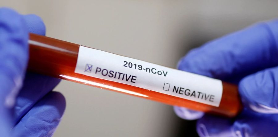 BRASIL TEM 22,1 MIL CASOS DE COVID-19. MORTES CHEGAM A 1,2 MIL